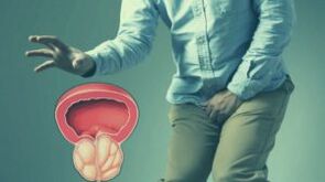 Akutni prostatitis